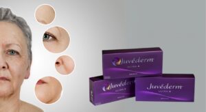 Juvederm Ultra 2, 3 e 4: scopri le differenze e quale scegliere