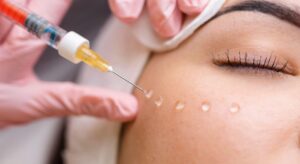 Trend filler 2026: l’evoluzione è già iniziata